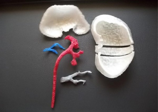 Biomedical and 3D printing integration to Simulate Endoscopic