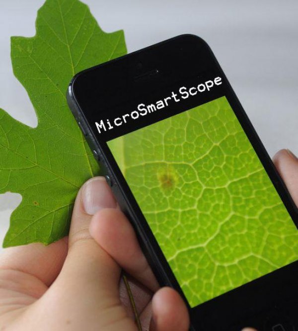 MicroSmartScope: e se il tuo smartphone diventasse un microscopio?